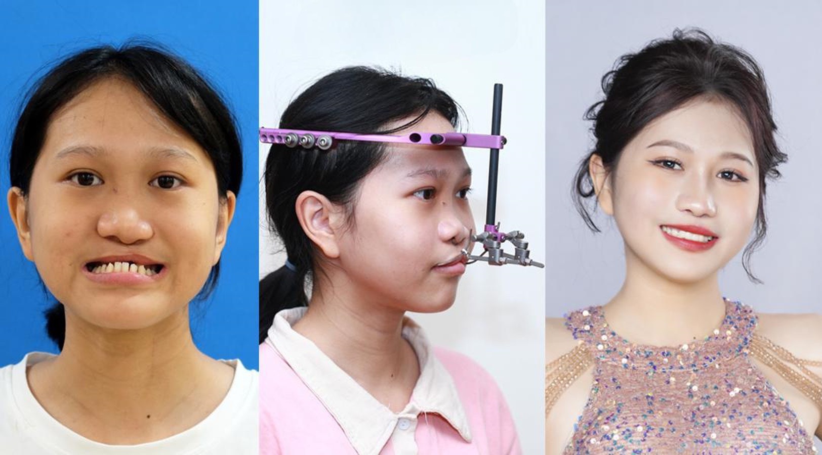 Hành trình thay đổi ngoạn mục của Xuân Mai khiến mọi người ngỡ ngàng