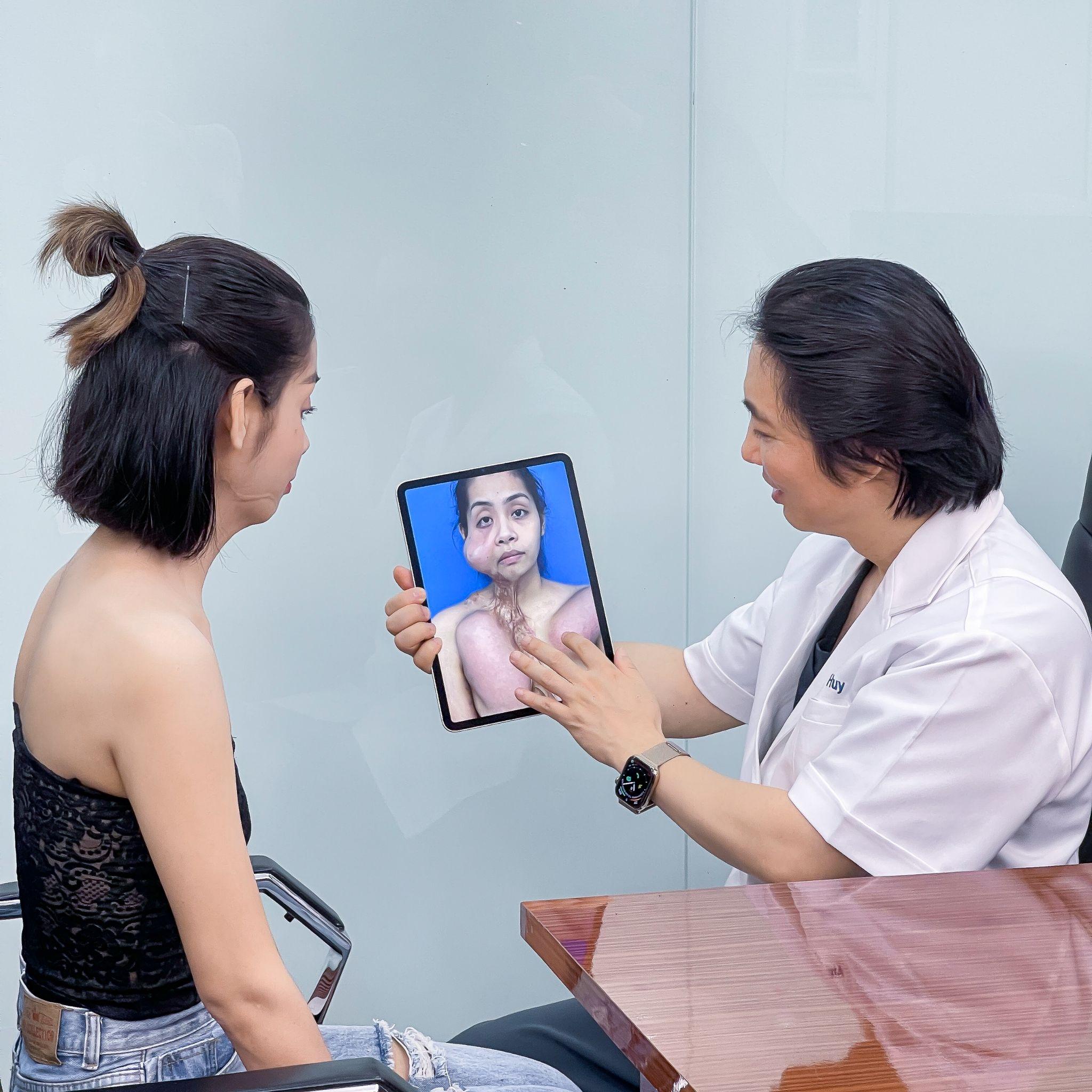 Trường hợp sẹo co kéo nặng của Diệu Linh được TS.BS Richard Huy khắc phục hoàn hảo