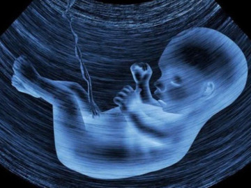 Al hỗ trợ bác sĩ siêu âm phát hiện dị tật thai nhi nhanh hơn
