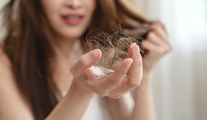 Nhiều người gặp phải tình trạng rụng tóc nghiêm trọng khi giảm cân, một trong các lý do chính là sự thiếu hụt dinh dưỡng.