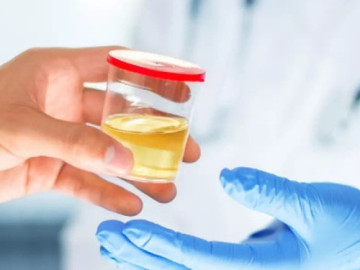 7 triệu chứng ban đầu của bệnh gan thường bị bỏ qua