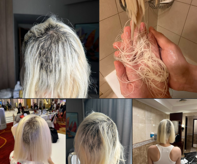 DJ Soda buộc phải cạo bỏ cả mảng tóc phía sau và 2 bên đầu.