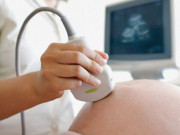 Các mốc siêu âm dị tật thai nhi quan trọng mẹ bầu cần ghi nhớ để có một thai kỳ khỏe mạnh