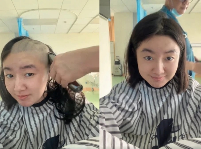 Cao Quân Vũ cắt tóc để mổ u não cũng là thật nhưng không còn được khán giả cảm thông.