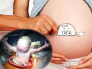 Mẹ bầu sinh mổ vẫn có thể cho con trải nghiệm gần như sinh thường nhờ phương pháp sinh kiểu mới