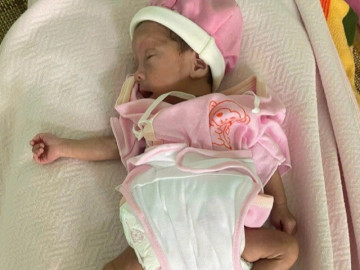 Hành trình mạnh mẽ của em bé 1kg: Sự nhiệm màu viết bằng nước mắt, sữa mẹ và ánh sáng hy vọng (P3)