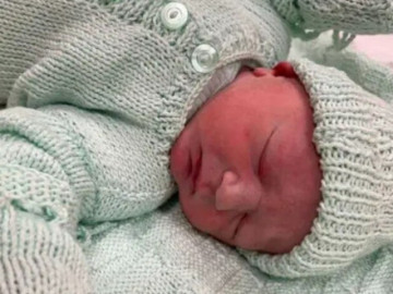 Tưởng mang thai đôi, hóa ra là 3 nhưng chỉ còn 1 bé chào đời: Sự thật về hội chứng   thai biến mất 