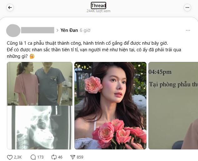 Những hình ảnh Yên Đang chỉnh sửa sắc đẹp bất ngờ hot trở lại.