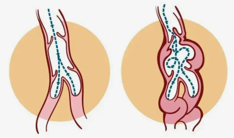 Căn bệnh này ảnh hưởng đến khả năng sinh sản của nam giới. Ảnh minh họa.