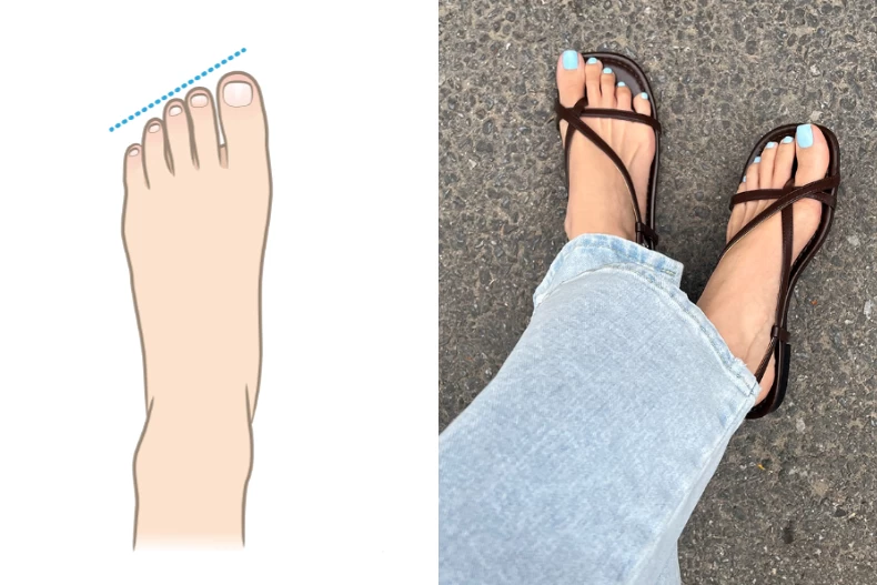 Dáng chân Ai Cập phù hợp với các mẫu sandal mũi rộng hoặc vuông 