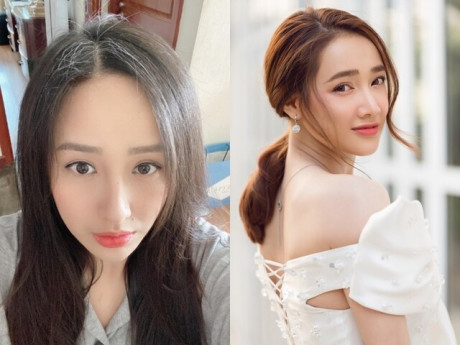 Sao Việt trẻ trung mơn mởn mà tóc đã bạc, đến Hoa hậu cũng lộ khuyết điểm nơi đỉnh đầu