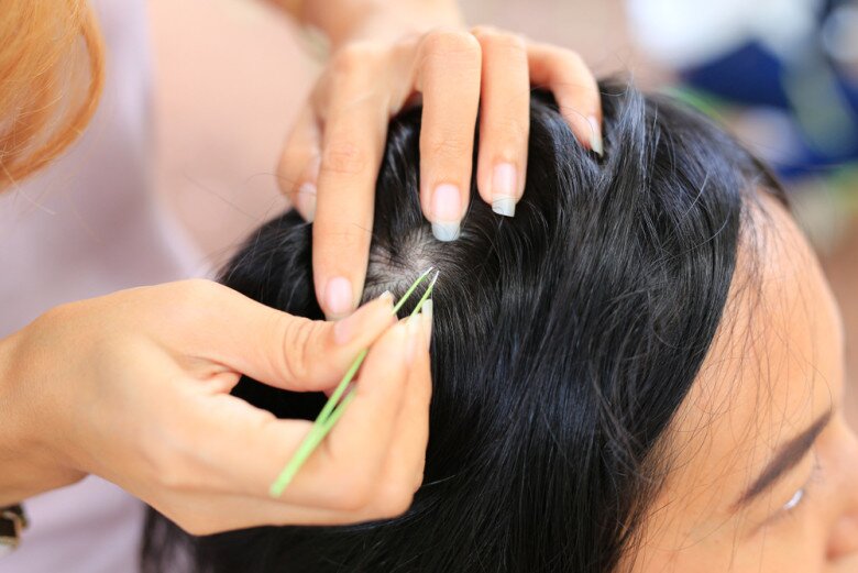 Nhổ tóc bạc không chấm dứt tình trạng này.
