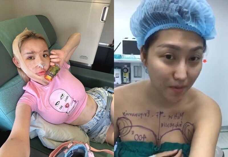 Phẫu thuật thẩm mỹ là phương pháp làm đẹp ngày một phổ biến, được nhiều người lựa chọn, nhất là các sao nữ khi luôn muốn thăng hạng nhan sắc. Nhưng có những người từng là “tượng đài nhan sắc”, vì lạm dụng "dao kéo" mà gương mặt biến dạng đến mức khó cữu vãn.