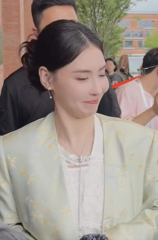 Góc nghiêng mặt cho thấy gò má của Bá Chi nổi bật bất thường, làm dấy lên nghi vấn cô tiêm filler (chất làm đầy) hoặc các thủ thuật thẩm mỹ khác trên gương mặt.