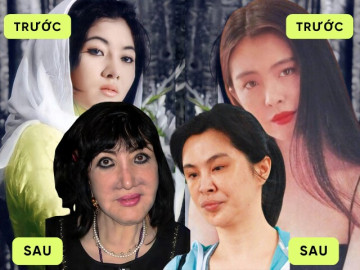 Sốc nặng với dàn mỹ nhân xinh đẹp nức tiếng một thời, gương mặt nay méo mó vì lạm dụng "dao kéo" quá đà
