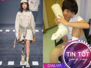 Tin tức - Sống sót thần kỳ sau trận động đất, cô gái hot rần rần với chiếc “chân thép ngầu đét”