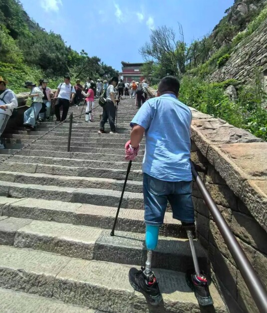 Anh Sheng có hơn 10 năm kinh nghiệm trong ngành chỉnh hình chân tay giả.
