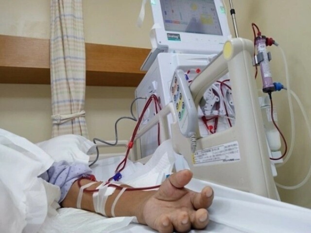 Hỏng thận tuổi 20