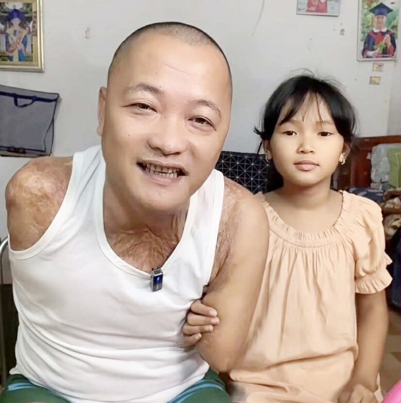Người cha khuyết tật không còn mặc cảm vì luôn có con bên cạnh