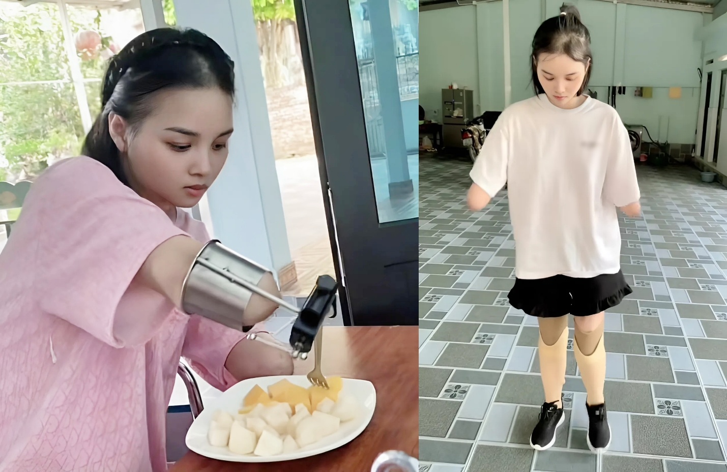 Chị Nga chăm chỉ tập luyện tay chân mỗi ngày