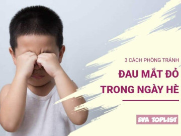 Giữ đôi mắt bé an toàn: 3 bí quyết phòng ngừa đau mắt đỏ mùa hè hiệu quả