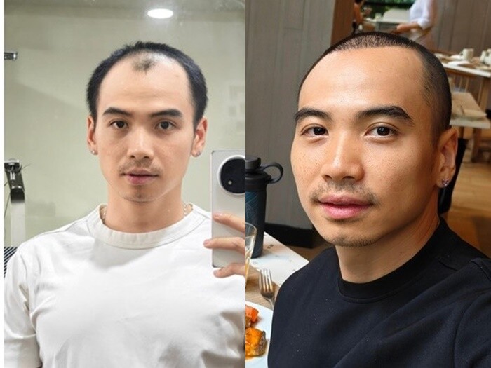 Ông xã của HHen Niê đổi ngoại hình sau khi kết hôn.