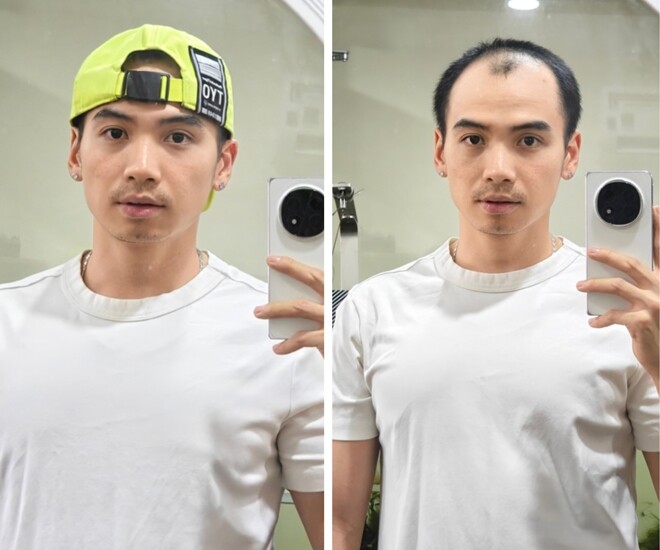 Chồng Hamp;#39;Hen Niê đi đâu cũng được hỏi amp;#34;đã mọc tóc chưaamp;#34;, hiện nổi tiếng hơn cả vợ hoa hậu - 5