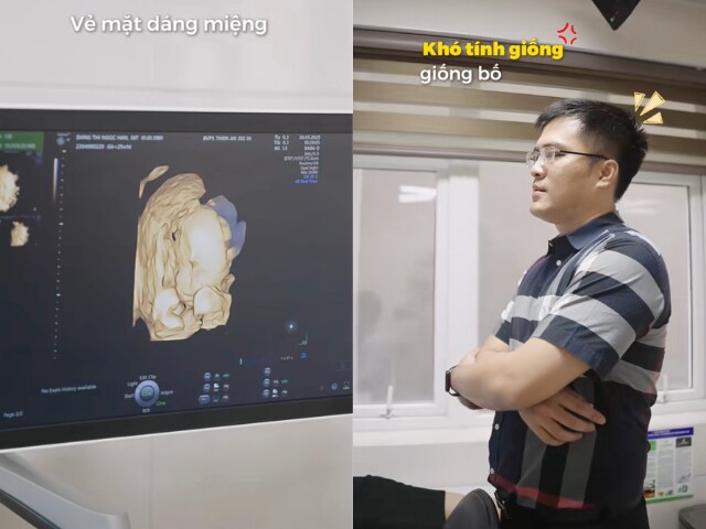 Bác sĩ nhận xét em bé có chân dài, mũi cao.