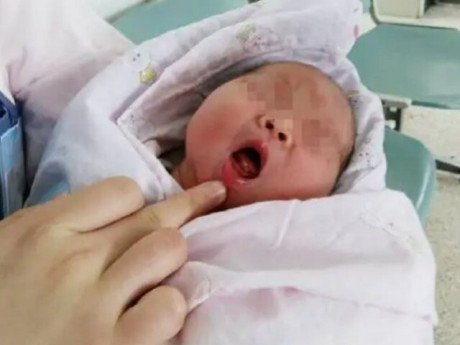 Bé sơ sinh vừa chào đời đã có răng, cả khoa hội chẩn: "Phải nhanh lấy nó ra!"