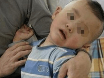 Mẹ sụp đổ khi biết thói quen tưởng tốt mỗi ngày của mình khiến con 7 tháng bị thiểu năng trí tuệ