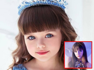 Bé gái nổi tiếng thế giới bị người lạ làm phiền vì quá xinh đẹp, 10 năm sau dậy thì xong nhan sắc thay đổi lớn