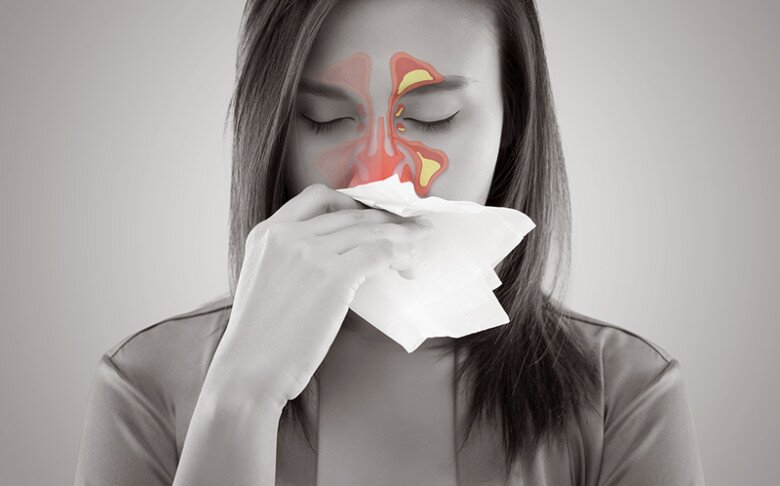 Viêm xoang không điều trị kịp thời ảnh hưởng rất lớn đến chất lượng cuộc sống. Ảnh minh họa. 