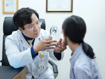 Nghe lời mách bảo nước cốt chanh thần thánh giúp đánh bay mụn, cô gái trẻ ôm mặt đi gặp bác sĩ gấp