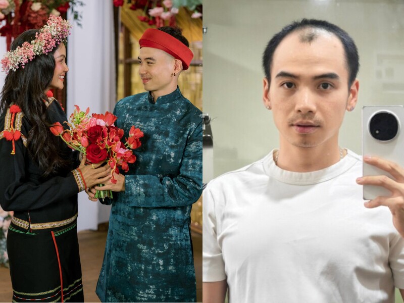 Những ngày vừa qua, nhiếp ảnh gia Tuấn Khôi - chồng Hoa hậu H'Hen Niê nhận được nhiều sự quan tâm khi quyết định can thiệp thẩm mỹ để cải thiện quả đầu ít tóc.