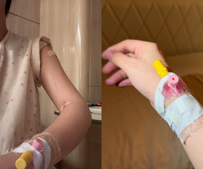 Puka để lộ hình ảnh cánh tay đầy vết kim tiêm.