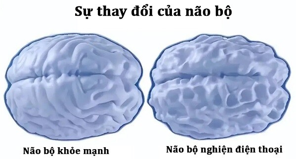 Não bộ trẻ amp;#34;nghiệnamp;#34; điện thoại và trẻ không chơi điện thoại âm thầm thay đổi, khác biệt lớn sau 10 năm - 5