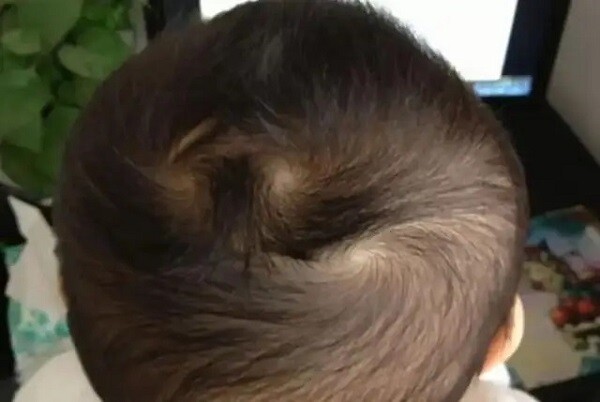Trong dân gian truyền rằng, trẻ có hai xoáy tóc thường nghịch ngợm và khó nuôi hơn.