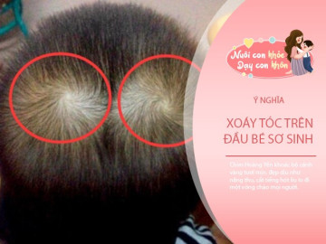 Em bé có nhiều xoáy tóc thì càng thông minh? Khoa học đưa ra giải thích rõ ràng
