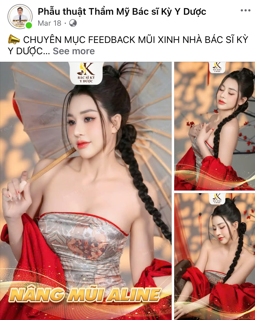 Dáng mũi Aline chuẩn từng milimet từ bác sĩ Kỳ Y Dược - 4