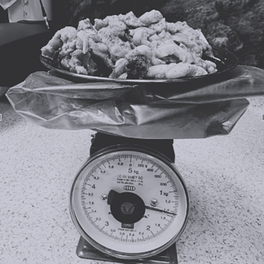 Toàn bộ khối u được bóc tách nặng hơn 1,4kg.