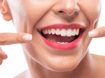 Nướu khỏe mạnh: Chìa khóa giữ gìn nụ cười rạng rỡ cho phái đẹp