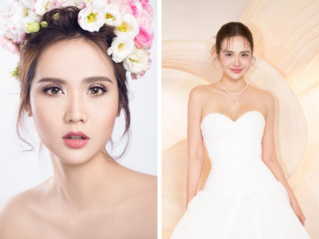 Huyền Lizzie trước khi tiêm vốn đã rất xinh đẹp, thế nhưng sau khi căn chỉnh, cô nàng lại còn “đẳng cấp” hơn 