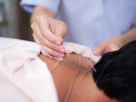 Chữa u lành bằng châm cứu tại quán net, người đàn ông suýt mất mạng vì thủng phổi