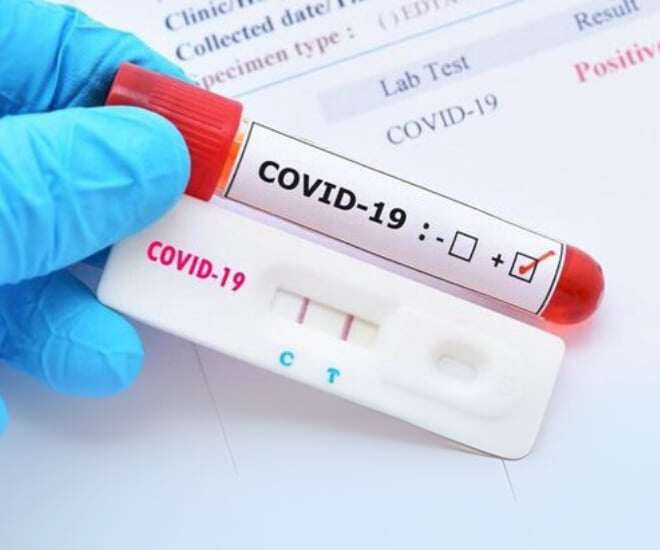 Một số quốc gia số ca mắc COVID-19 gia tăng trở lại. Ảnh minh họa. 