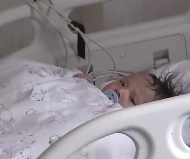 Bé 5 tháng tuổi không đi tiểu trong 20 giờ, bị sưng khắp người, bác sĩ phát hiện nguyên nhân đến từ bữa ăn hàng ngày - 1