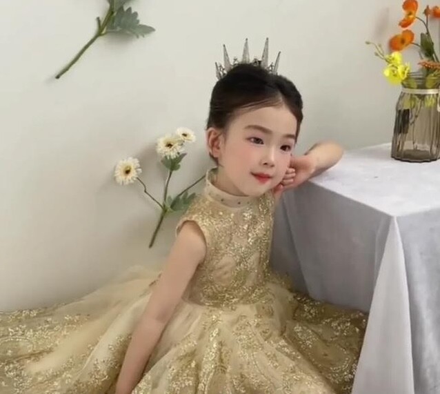 Bé gái 6 tuổi nổi tiếng sau một đêm vì có đôi mắt “kỳ lạ”, gia đình bật khóc khi nghe bác sĩ kết luận - 3