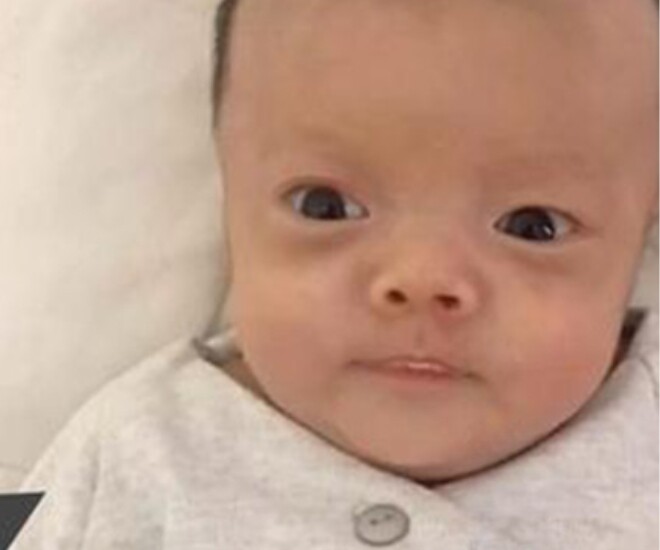 Bé sơ sinh chào đời có diện mạo như “ông già” suýt bị bỏ rơi, giờ đứa trẻ “lột xác” khiến mẹ ngỡ ngàng - 2