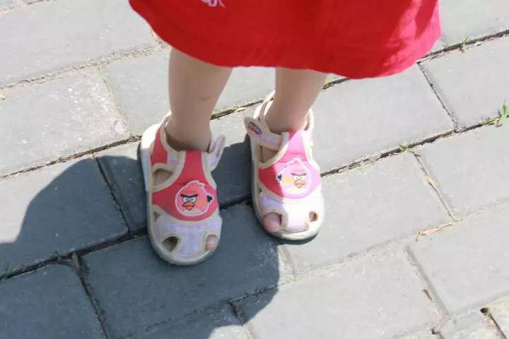 Bố đưa con 2 tuổi đi bơi, lúc về phát hiện ngón chân con phù lên đỏ tấy, đến bệnh viện bác sĩ báo tin sốc - 3
