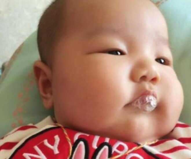 Con 2 tháng tuổi thường xuyên “thổi bong bóng”, mẹ tưởng hành động dễ thương nhưng bác sĩ bắt nhập viện ngay lập tức - 1