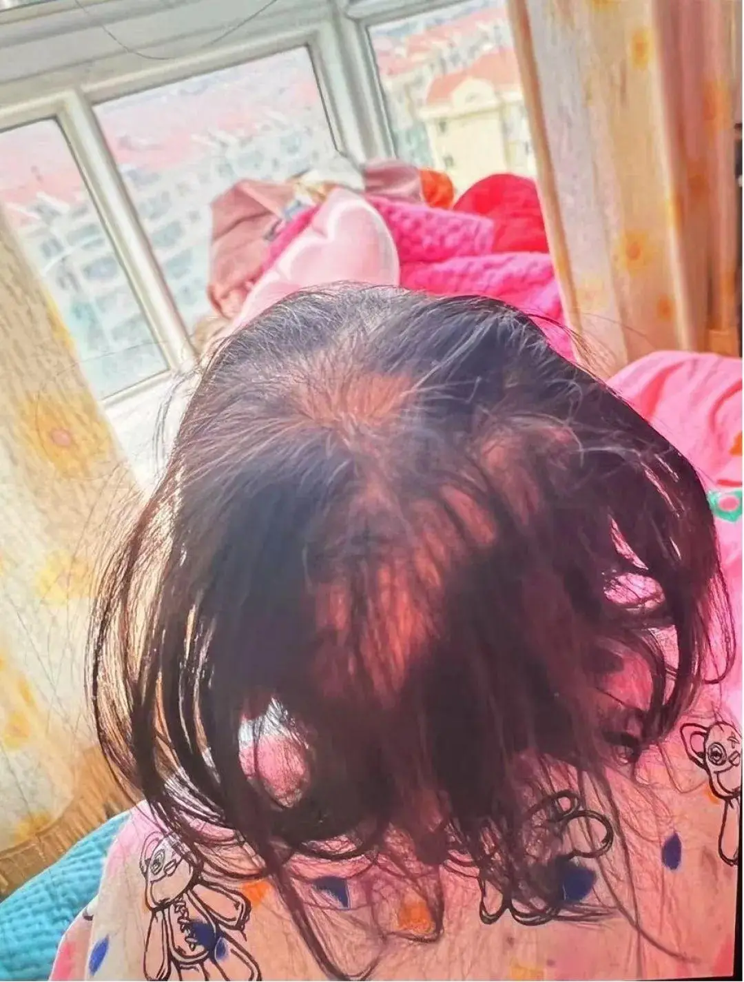 Con gái 3 tuổi rụng gần hết tóc, mẹ đưa đến bệnh viện, bác sĩ nói “Hãy báo cảnh sát” - 2